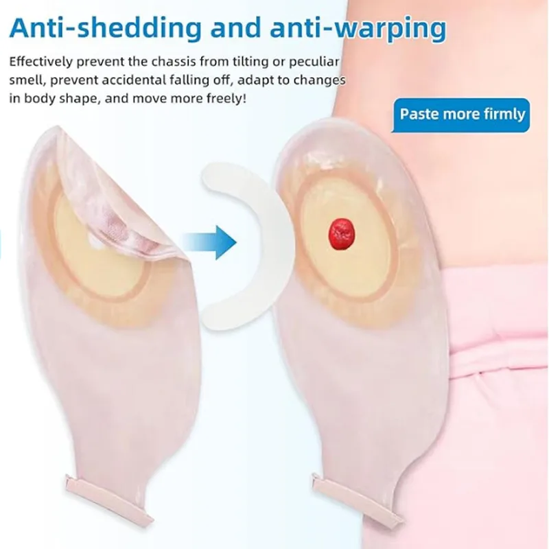 شريط تقوية لاصق طبي لحقائب فغر - مراجعة Medical Tape وسعره